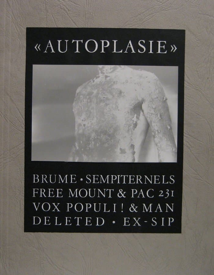Autoplasie