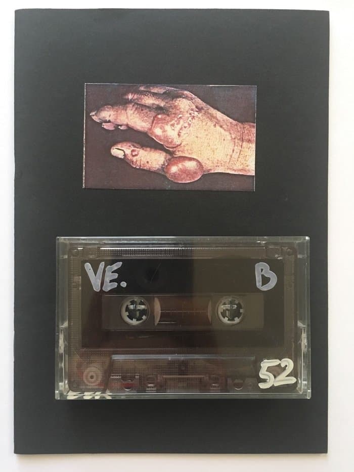 A Sound Atlas Of Venereology