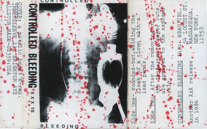 Controlled Bleeding