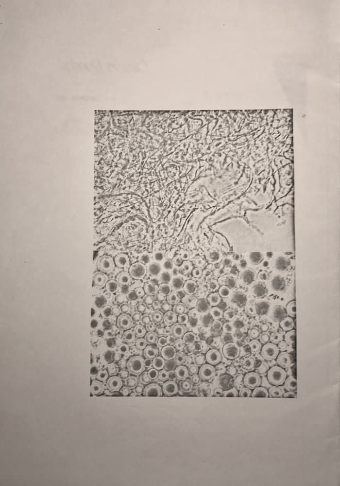 Trypanosoma