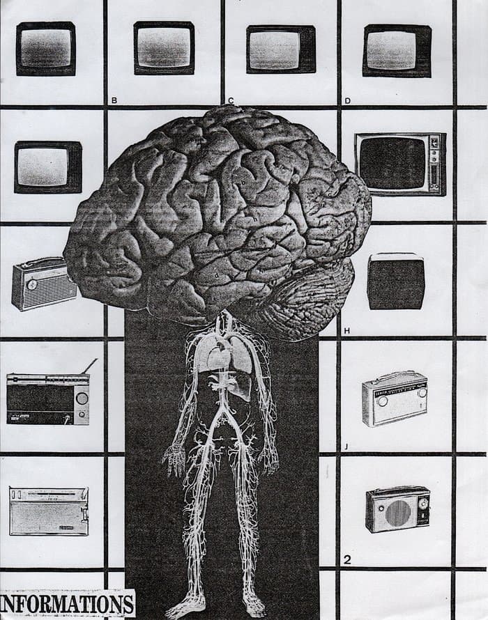 Mutations Et Prothèses