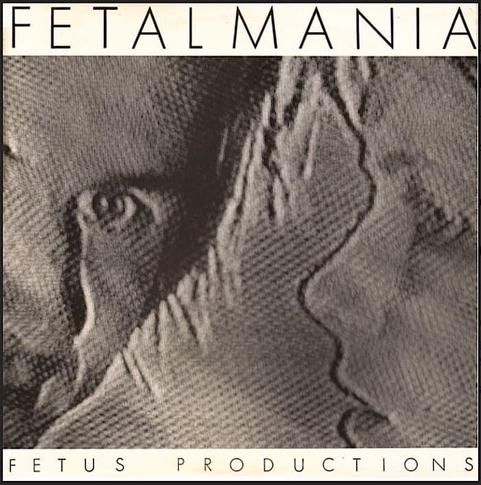 Fetalmania