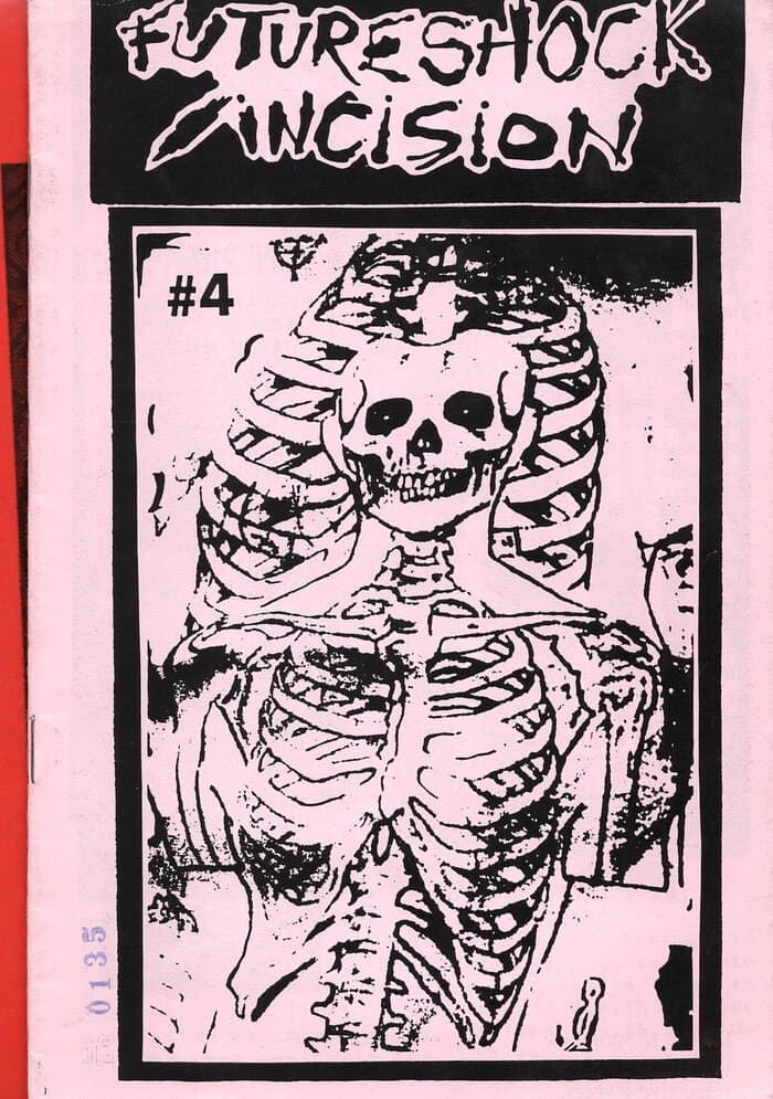 Futureshock Incision 4