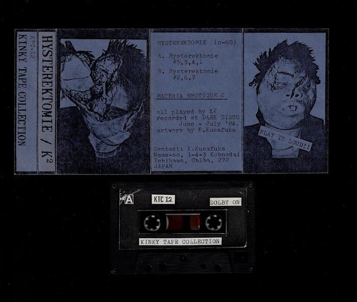 Hysterektomie