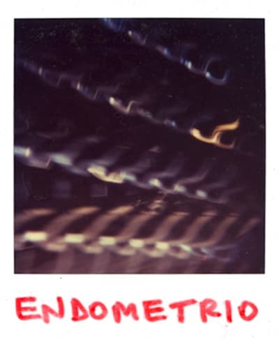 Endometrio
