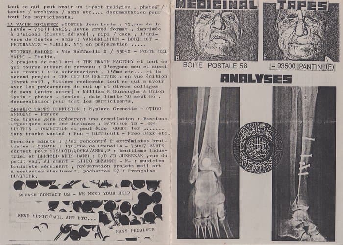 Tape-Overview
