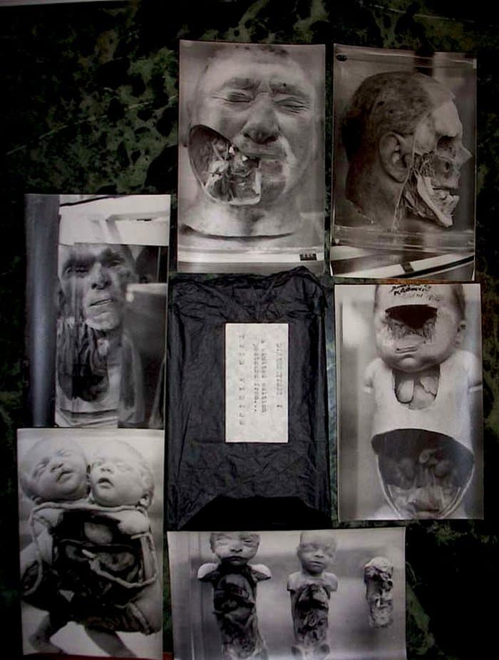 Dissection 1 - a Twin Vision Postcard Set