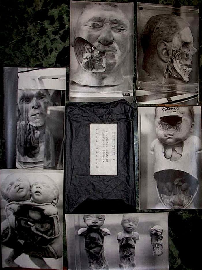 Twin Vision Dissektions - Set of 6 postcards (SPK Related)