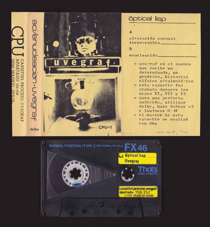 A.C.I./ Enucleación