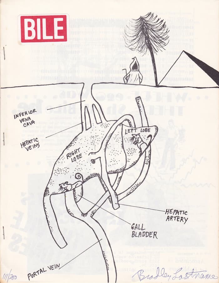Bile No. Ciro Heart - Inferior Vena Cava