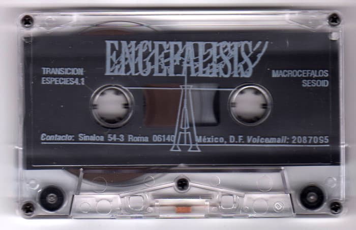 Encefálisis