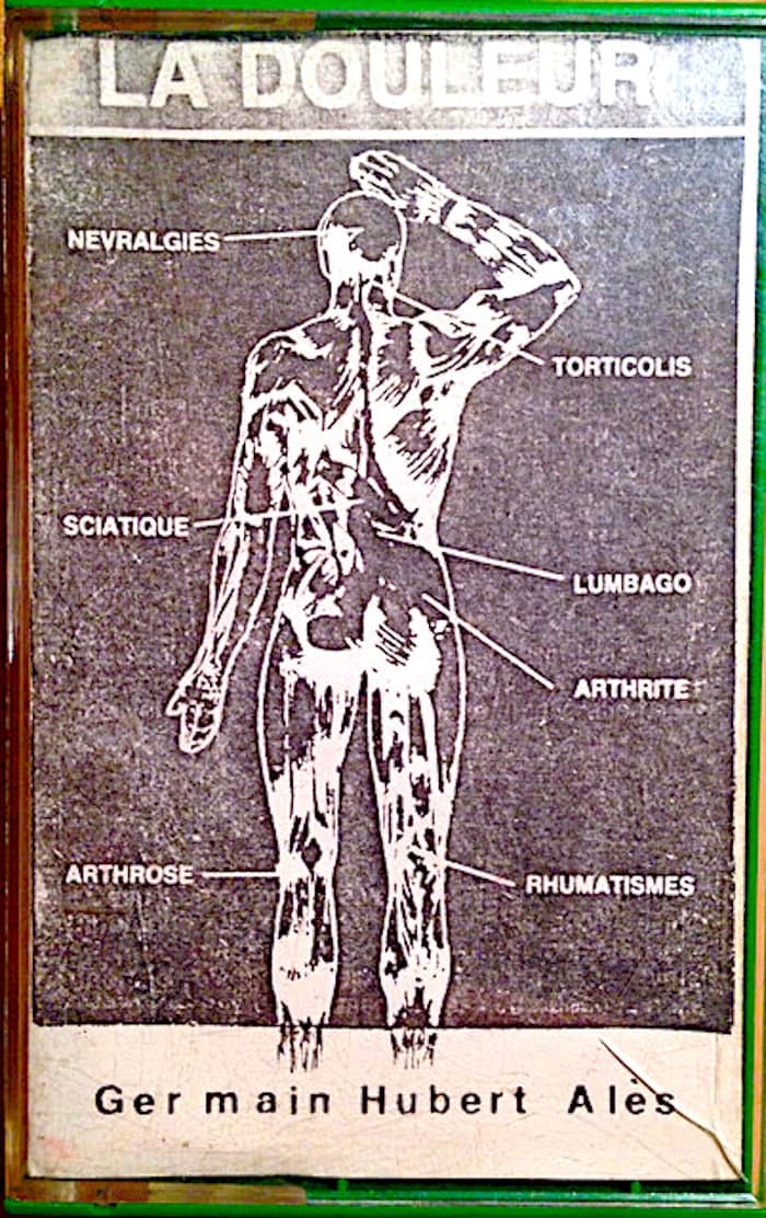 La Douleur