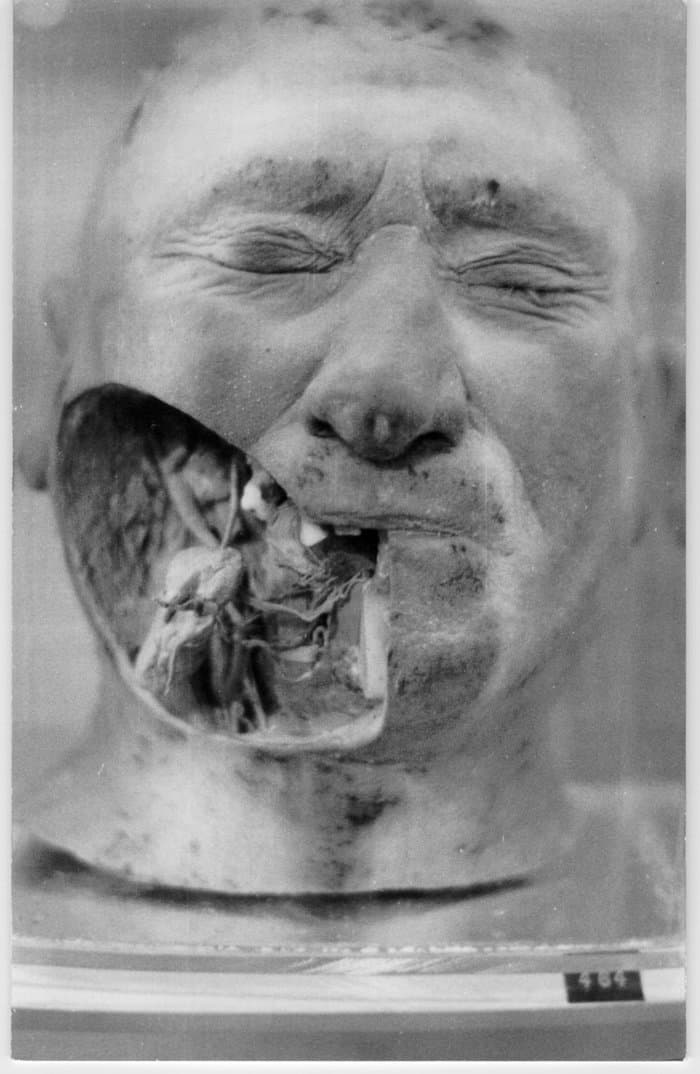 Dissection 1 - a Twin Vision Postcard Set