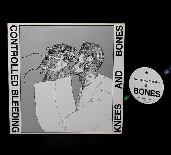 Knees and Bones