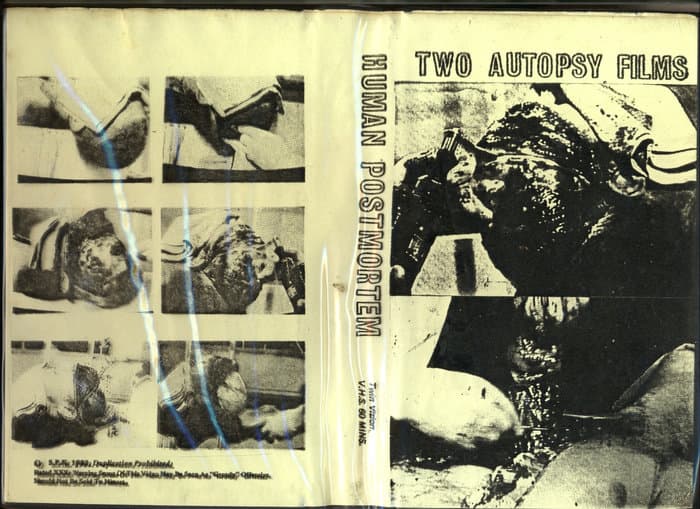 Two Autopsy Films