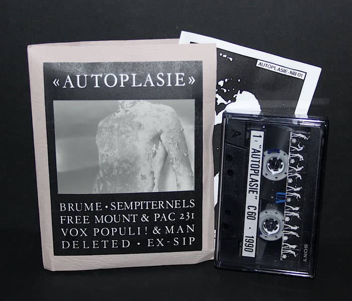 Autoplasie